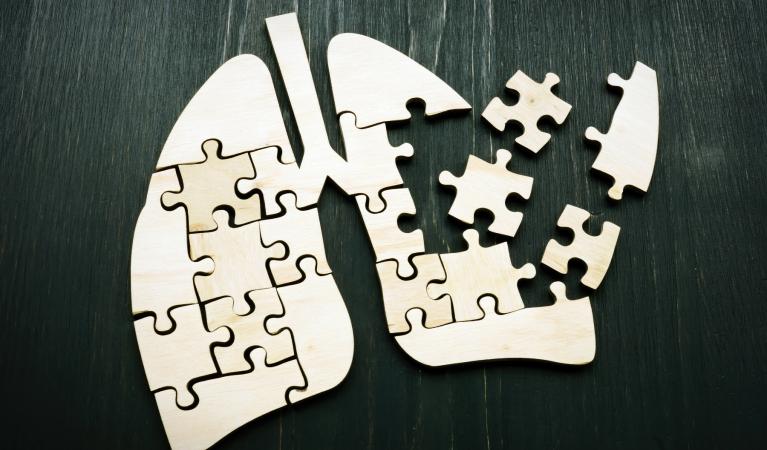 Lungor gjorda av pusselbitar. Några bitar saknas.