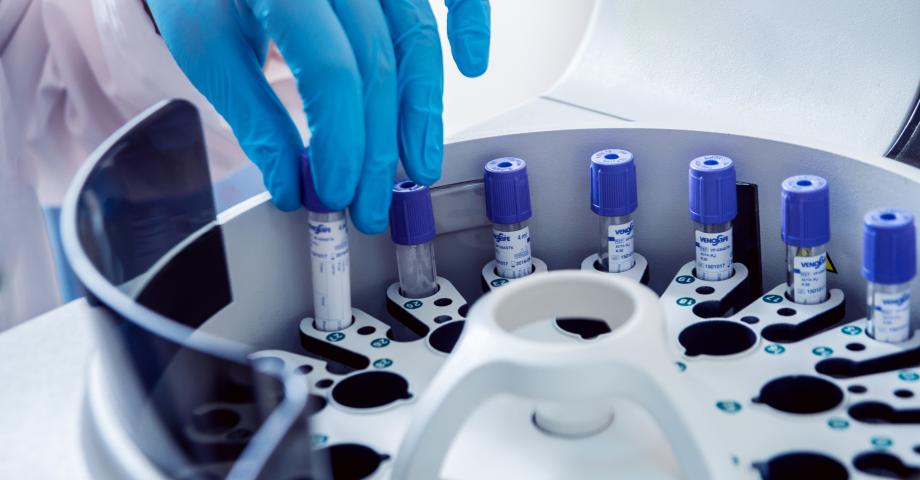 Blood samples are placed in a centrifuge.