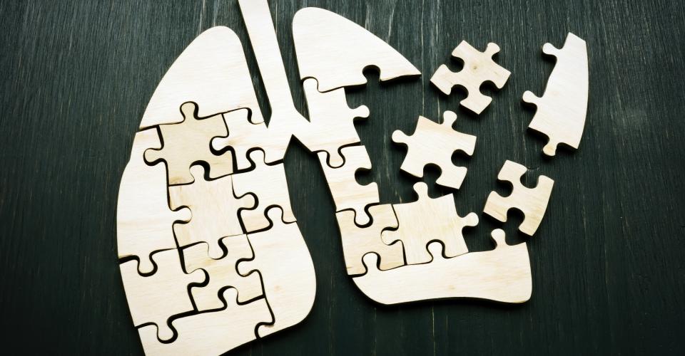 Lungor gjorda av pusselbitar. Några bitar saknas.